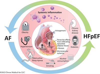 Heart failure with preserved ejection fraction and atrial fibrillation: clinical management in the context of recent therapeutic advances in heart failure and electrophysiology